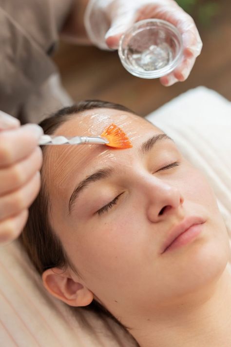 Can Inno Peel Reduce Post-Acne Spots And Scars?