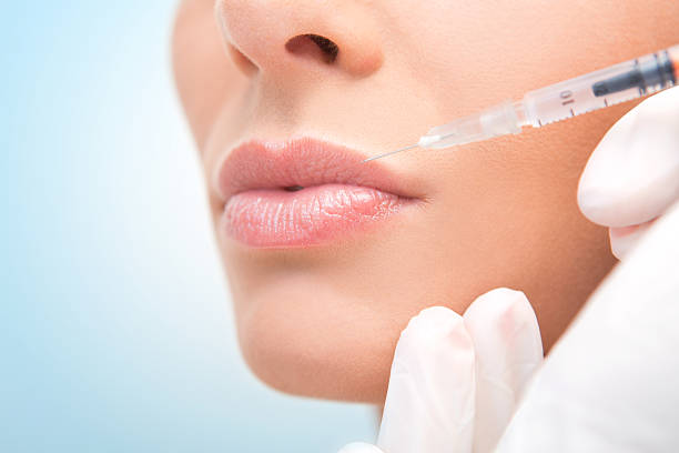 Can Lip Fillers Injection Fix Lip Volume Loss Fast?