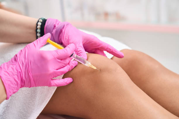 Can PRP injections for knees treat early arthritis?