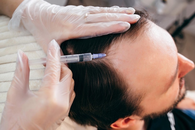 Does Hair Follicles Respond Well to GFC Therapy?