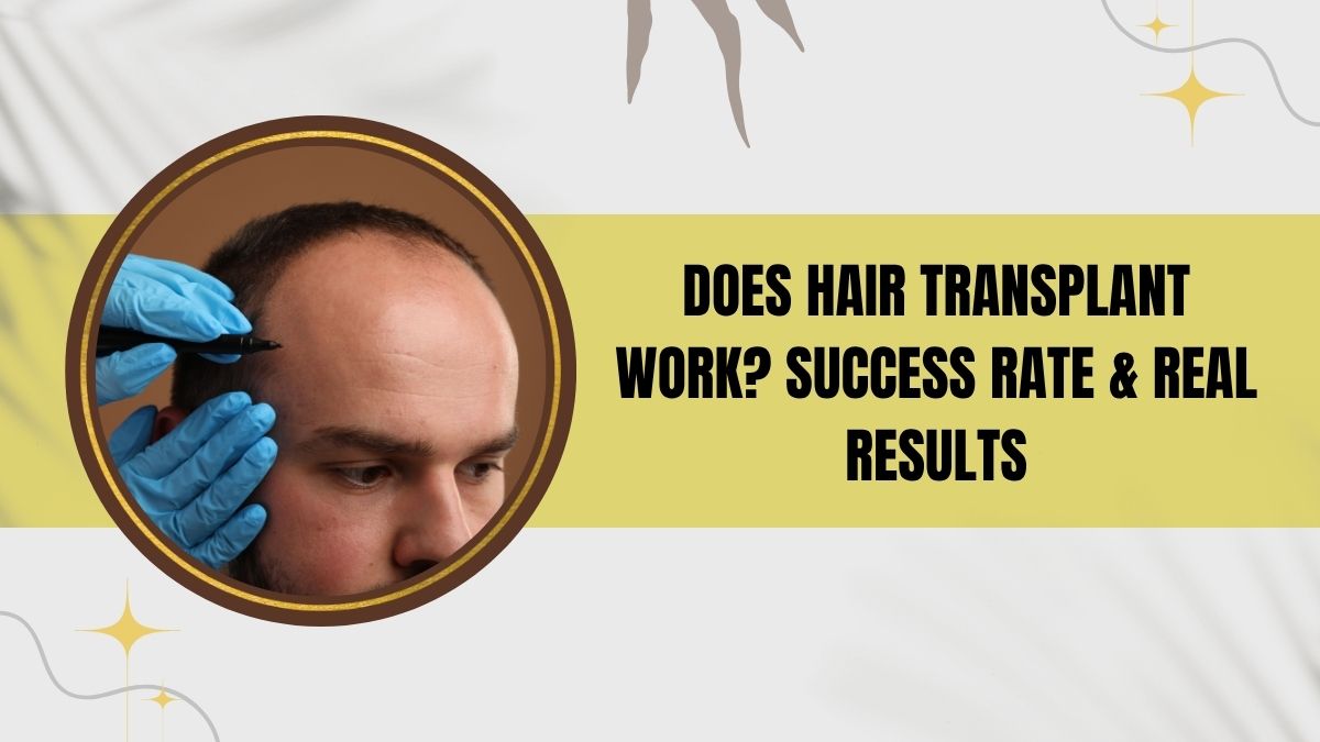 Does Hair Transplant Work? Success Rate & Real Results