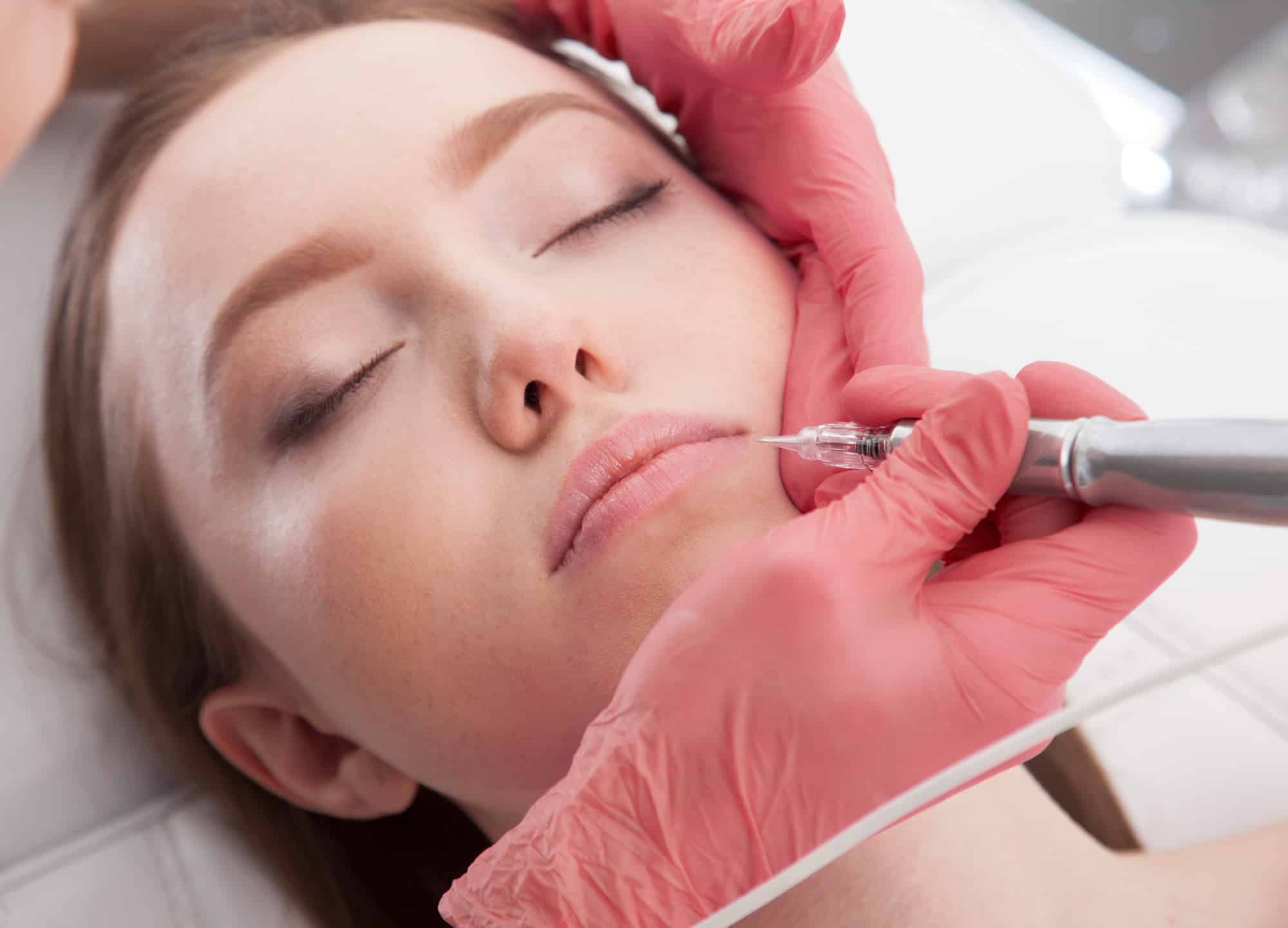 Does Plasma Pen Treatment Work on Loose Facial Skin?