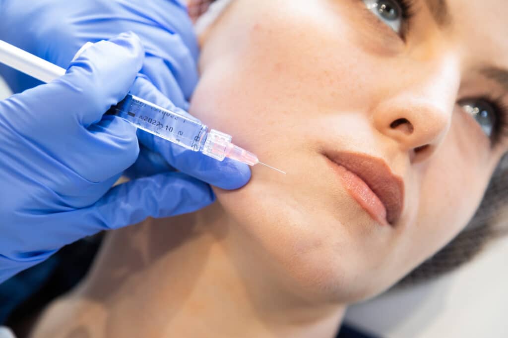 Does jawline filler help achieve v shaped face look?