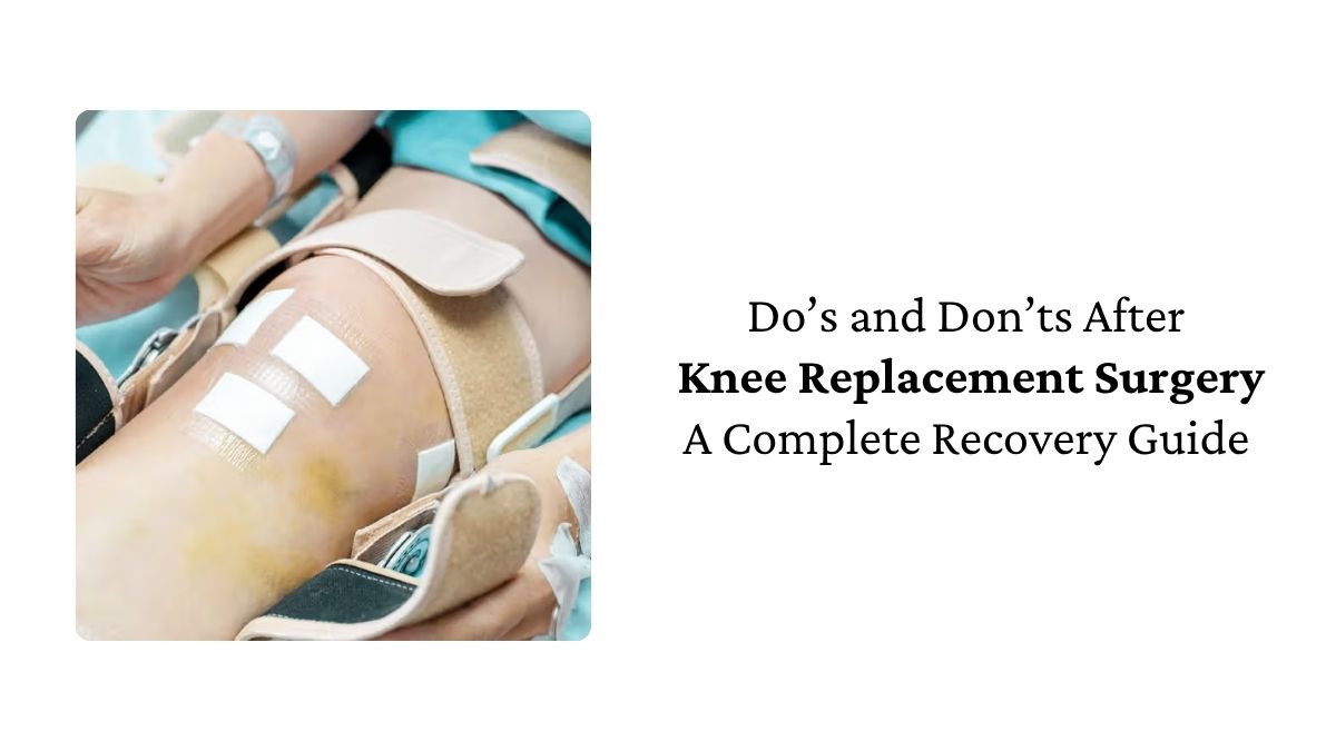 Do’s and Don’ts After Knee Replacement Surgery: A Complete Recovery Guide