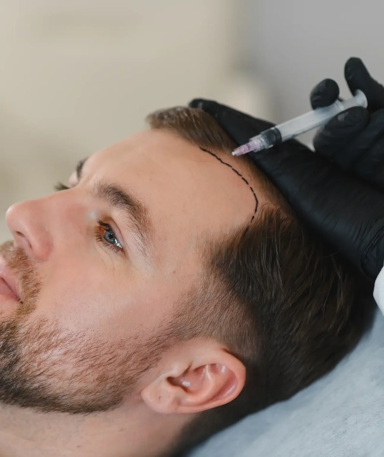 Hair Transplant In Dubai: Regain Confidence with Advanced Hair Restoration