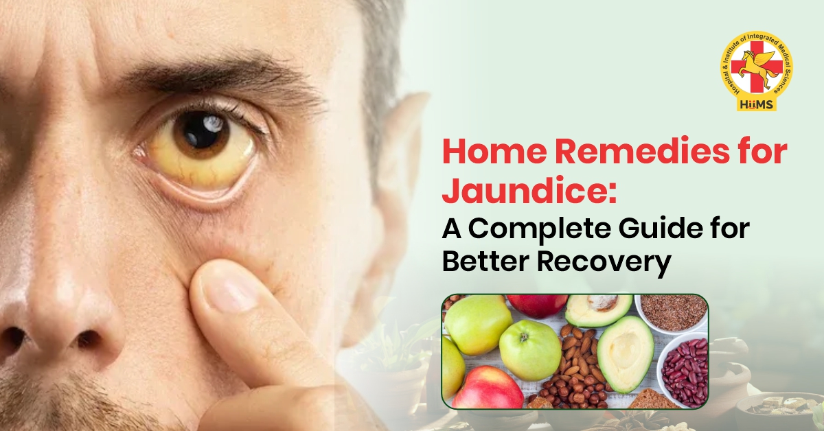 Home Remedies for Jaundice: A Complete Guide for Better Recovery