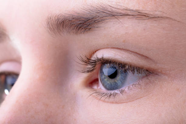 How Can Eyelid Surgery Refresh Your Face Without a Big Change