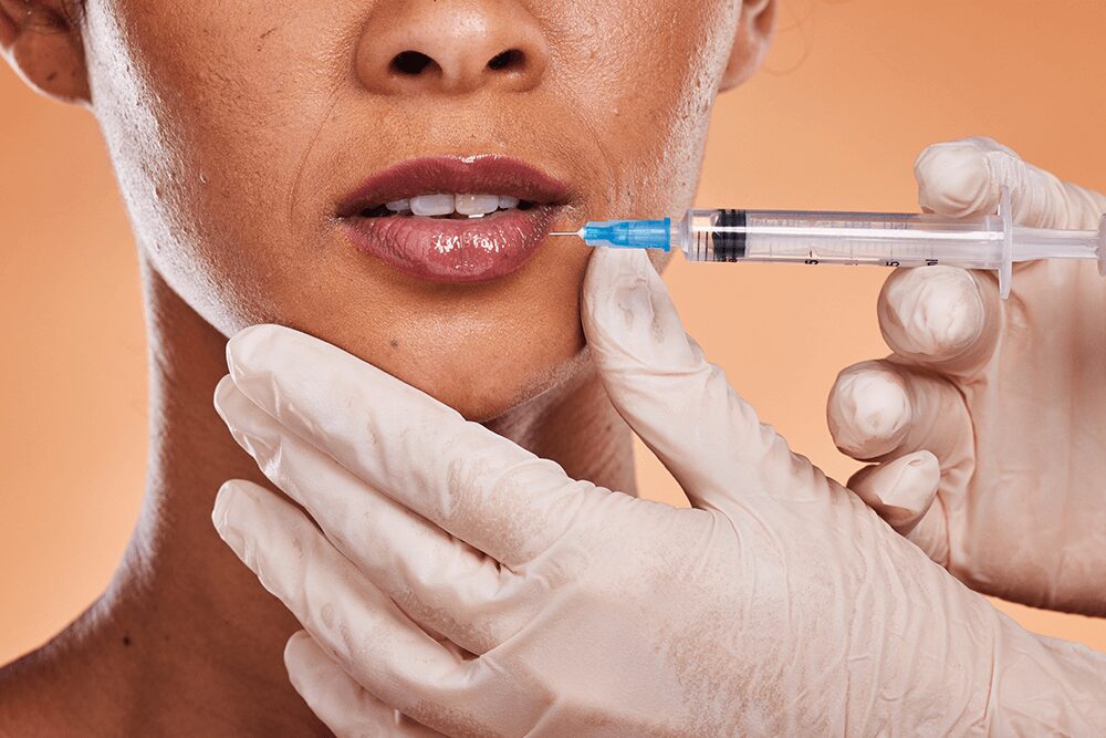 How Does Lip Flip Refine Lip Definition Appearance?