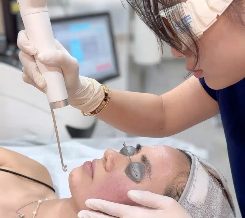 How Pico Laser Treatment in Abu Dhabi Reduces Fine Lines