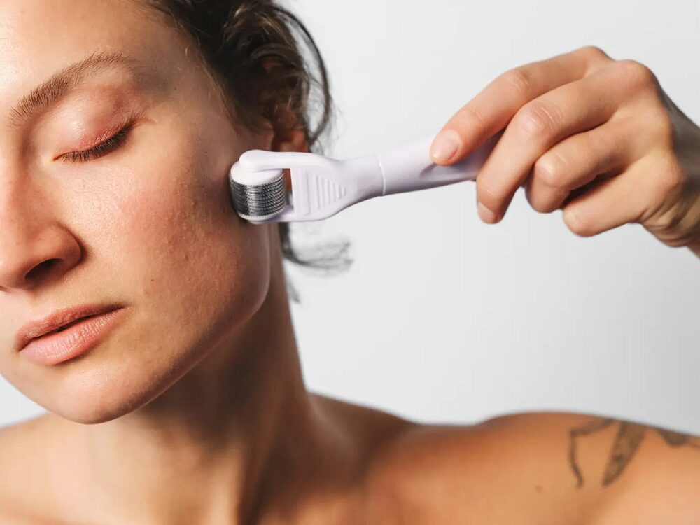 Is Derma Roller Treatment Better Than Microneedling?