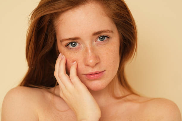 Is LASER Melasma Treatment the Best Solution?