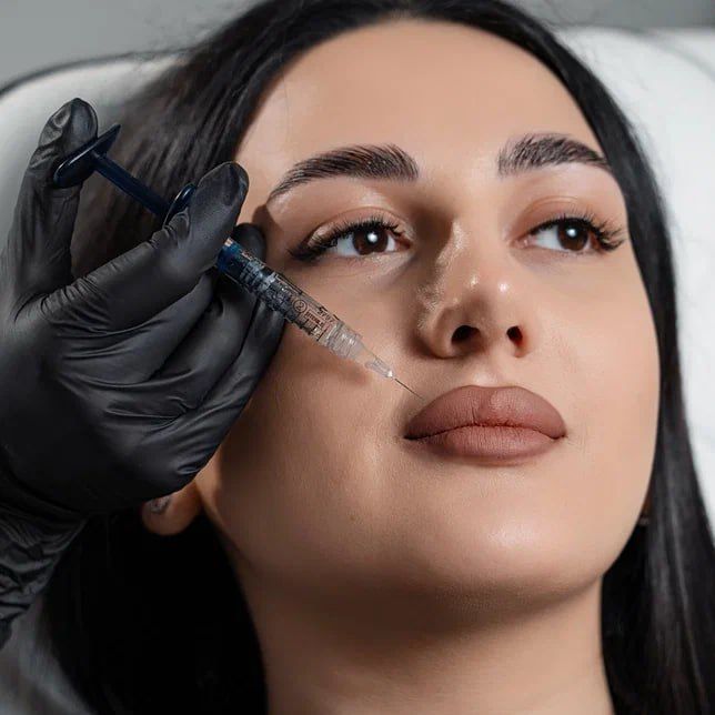 Is Sculptra Filler Effective for Long Term Skin Rejuvenation?