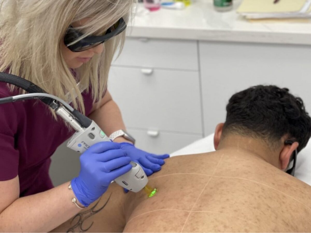 Laser Hair Removal for Men: Everything You Need to Know