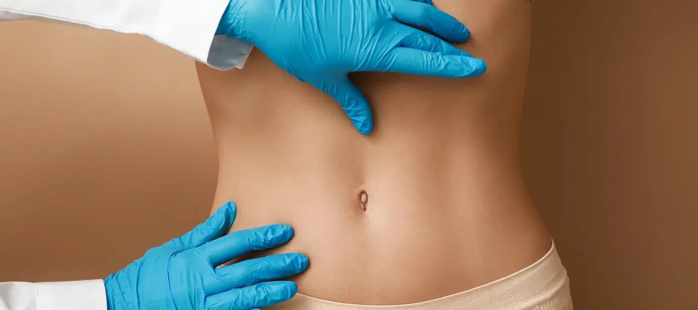 What Is the Purpose of a Tummy Tuck Treatment?