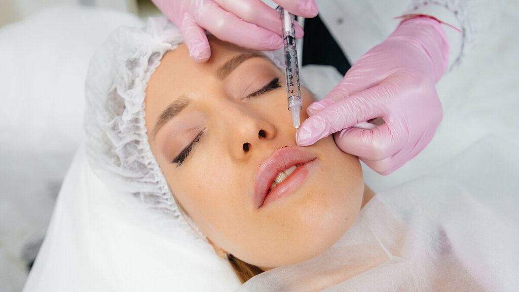 What Are Lip Fillers and How Do They Enhance Your Lips?