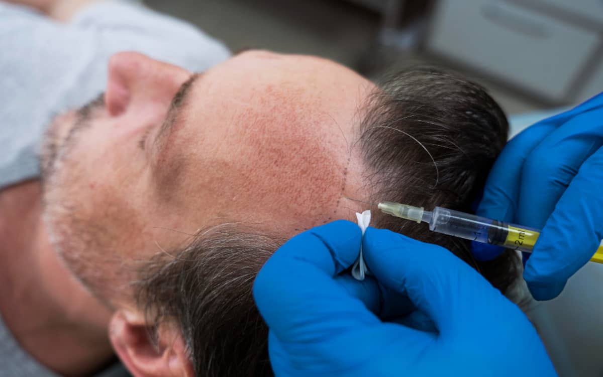 What Is G Cell Hair Treatment and How Does It Work?