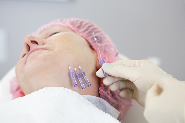 What Makes PDO Mono Threads So Popular Today?