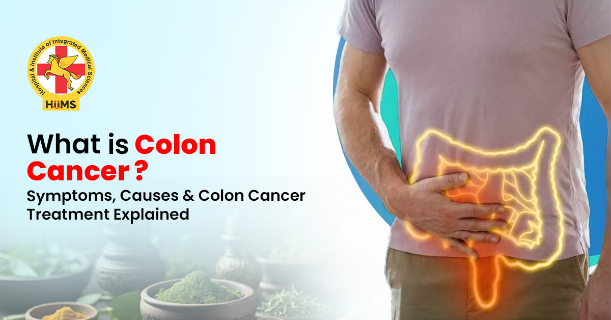 Understanding Colon Cancer: Early Signs, Causes & Natural Care Approach