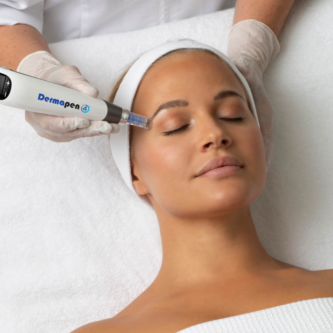 Why Is Dermapen Microneedling Popular For Skin Renewal?