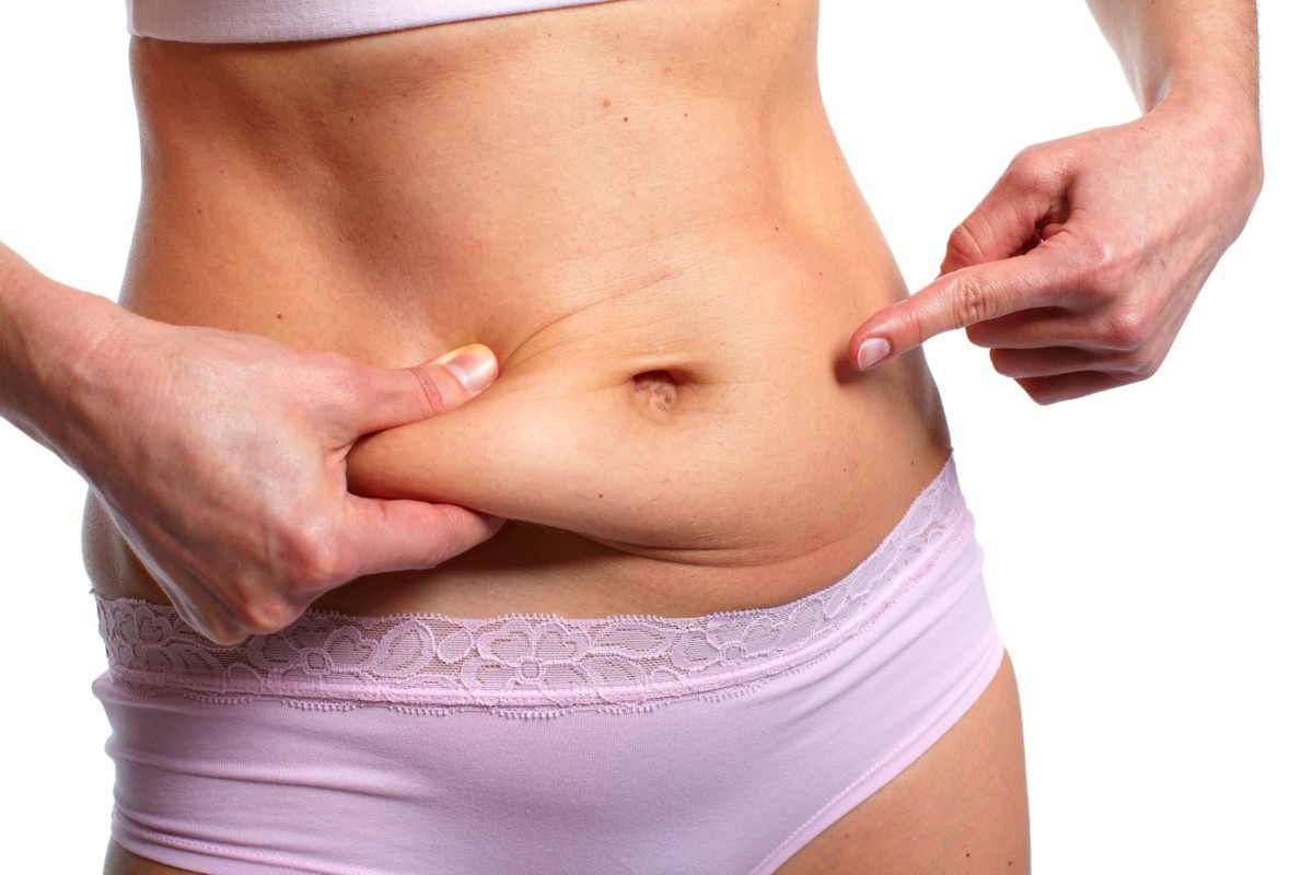 ماذا تُظهر نتائج تقنية نحت الجسم بالتبريد وتجميد الدهون؟