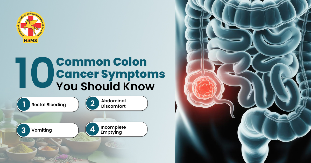 Colon Cancer Symptoms: Early Signs of Colon Cancer, Causes, and Treatment Explained