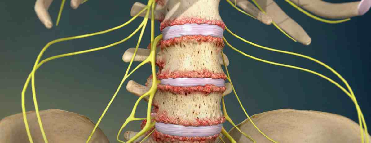 Effective Back Pain Treatment in Fenton, MI for Long-Term Relief
