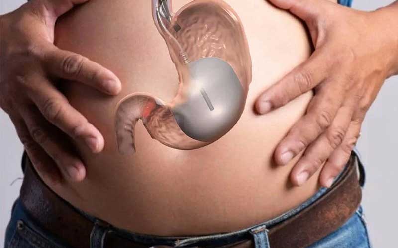 How does Allurion Gastric Balloon Clinic reshape wellness journey fast?