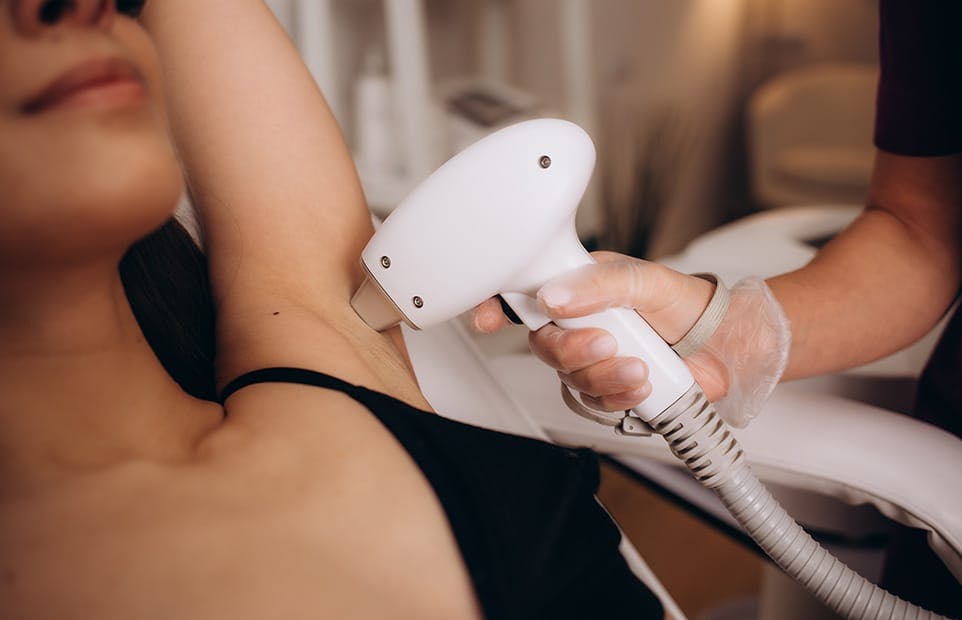 Can Laser Hair Removal Remove Facial Hair from Body?