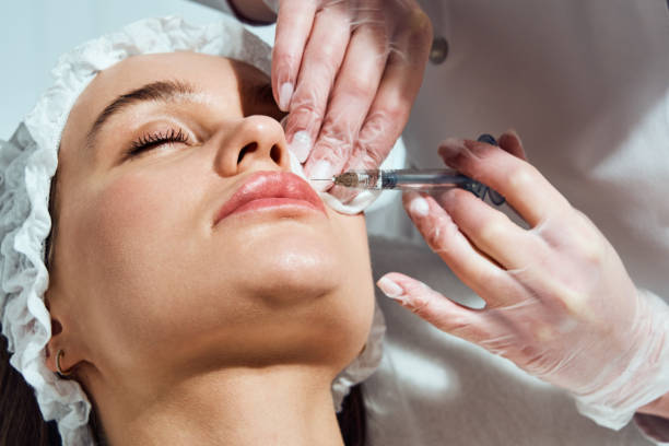 Can Lip Fillers Injection Fix Lip Lines and Wrinkles?