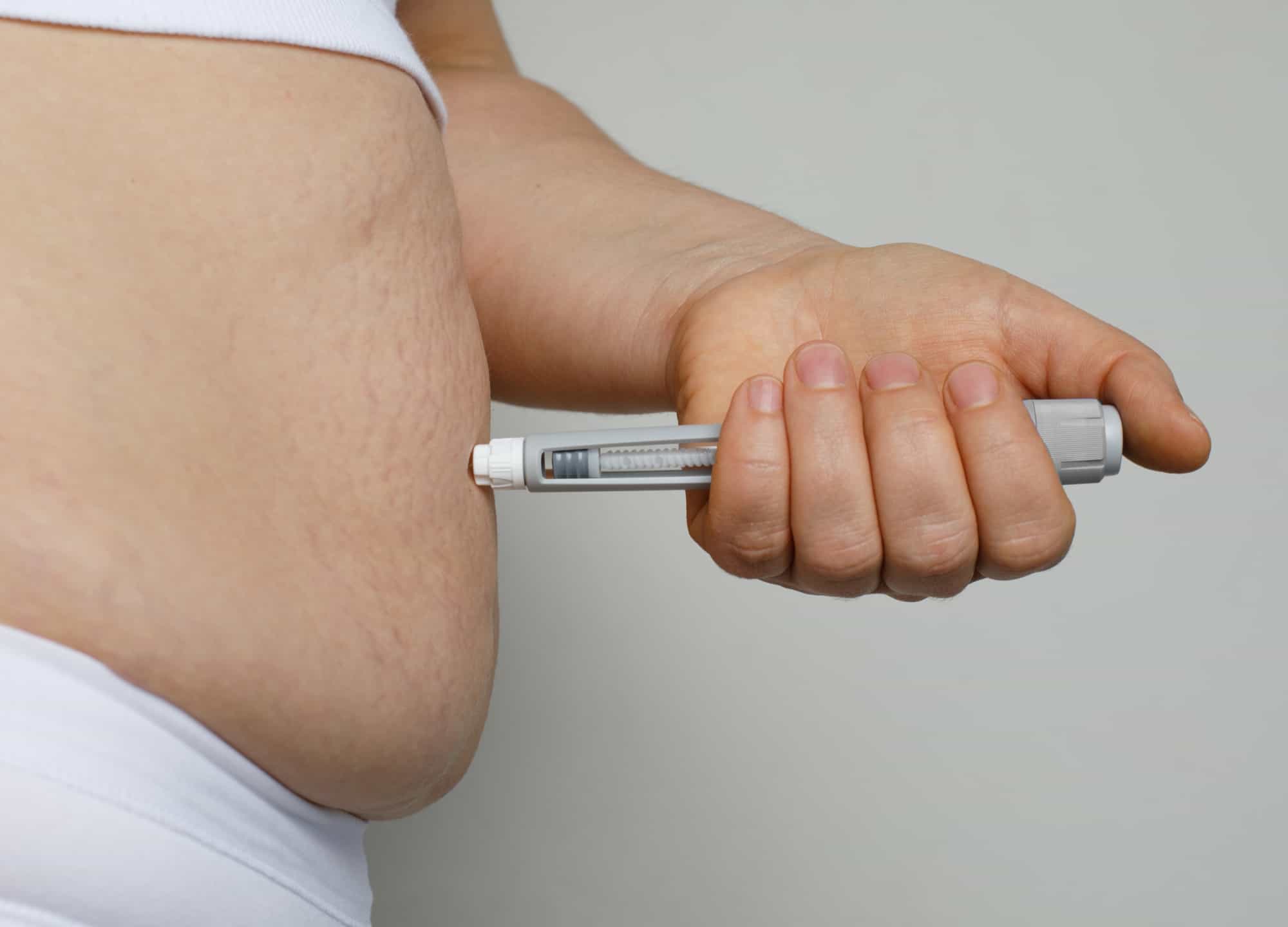 Can Mounjaro Injection Support Obesity Management Goals?