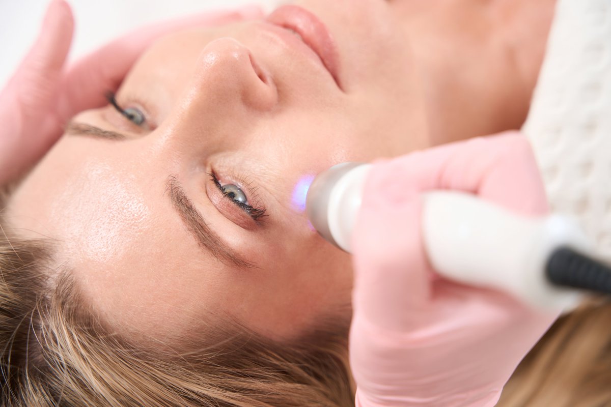 Can Pico Laser Treatment Reduce Skin Discoloration Fast?