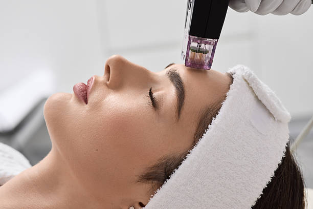 Can RF Microneedling Improve Skin Tone Naturally?