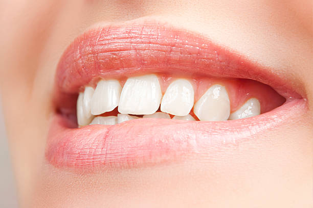 Can Teeth Whitening Remove Nicotine Stains Fast?