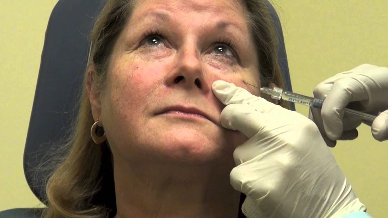 Can Under-Eye Filler Treatment Make Eyes Look Brighter?