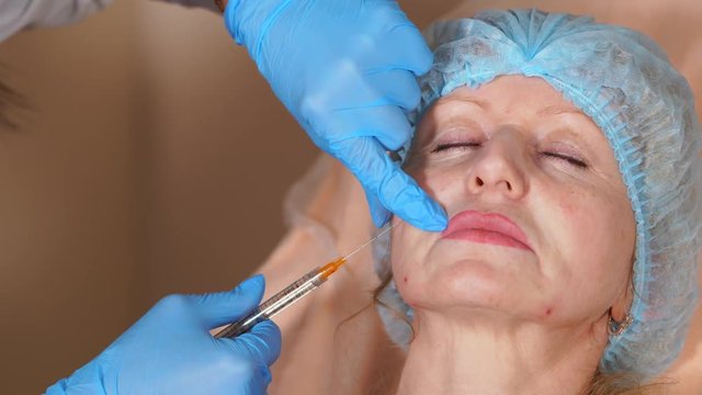 Can Volift Fillers Improve the Look of Your Entire Face?