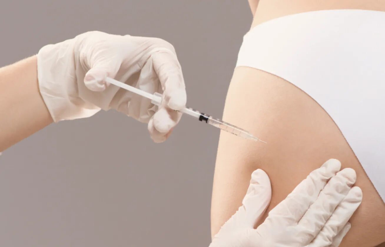 Can body fillers improve cellulite appearance quickly?
