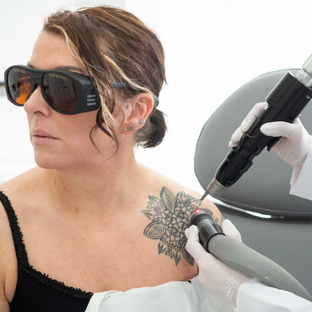 Clear Skin Confidence with Advanced Tattoo Removal
