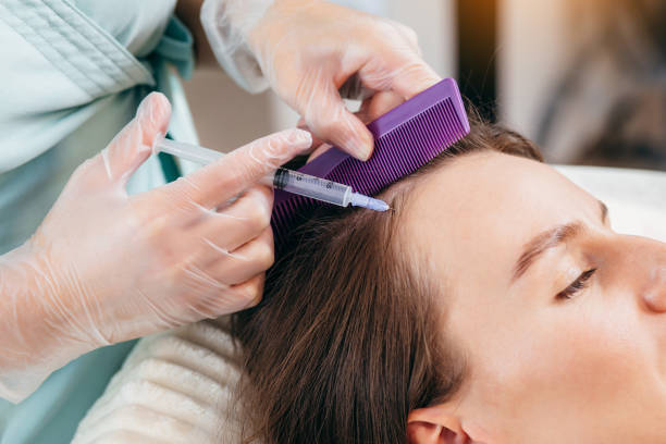 Does Best PRP Hair Treatment Help Hair Volume?