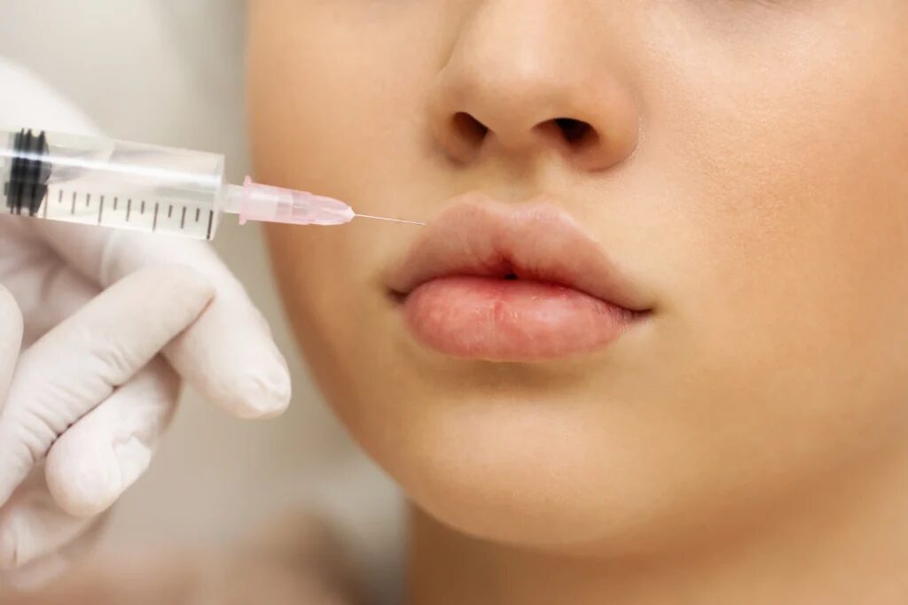 Does Lip Filler Help Correct Uneven Lip Contours?
