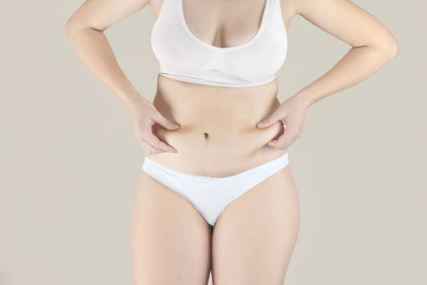 Does Vaser 4D Liposuction Create Better Waist Curves Naturally