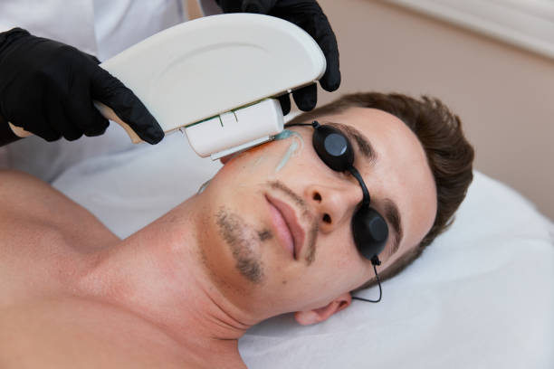 Does laser hair removal for men hurt sensitive skin?