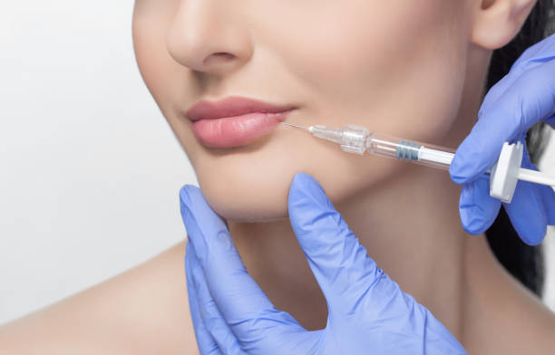 How Can Russian Lip Fillers Improve Lip Shape Naturally
