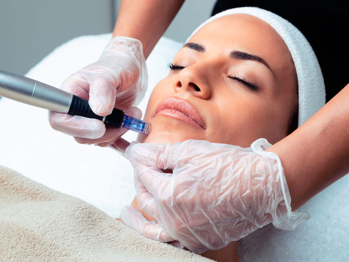 How Dermapen treatment in Abu Dhabi Improves Skin Tone