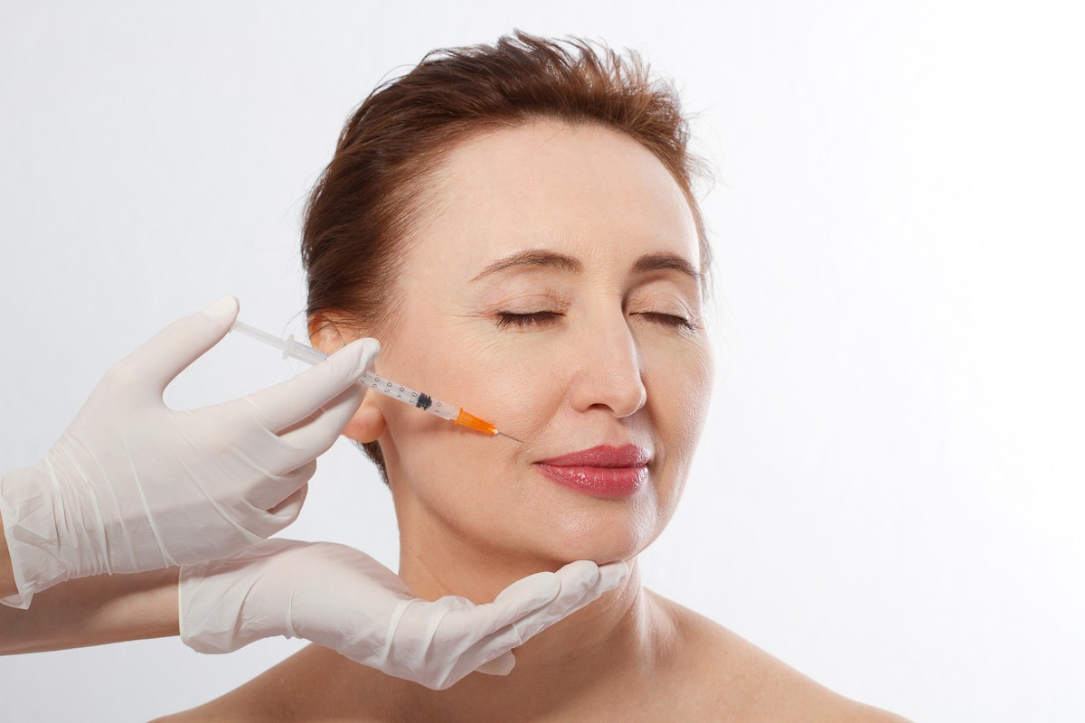 How Does Best Radiesse Filler Create a Lifting Effect?