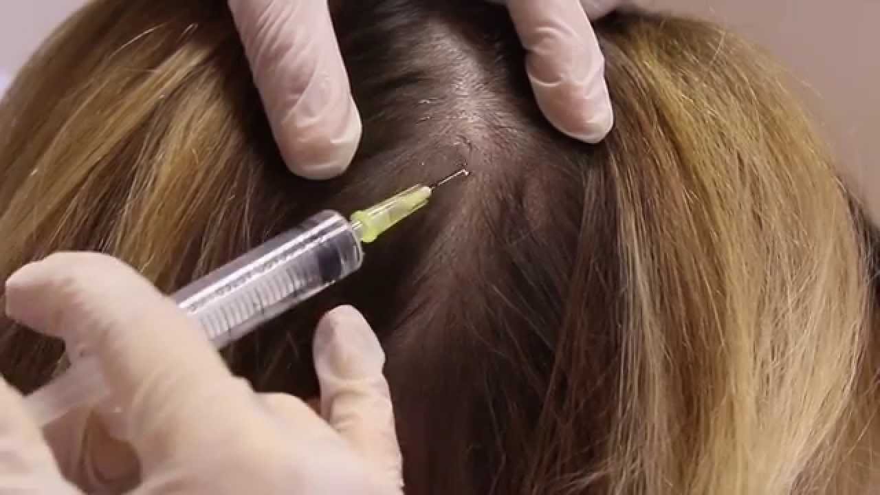 How Does G Cell Hair Treatment Control Excess Hair Fall?