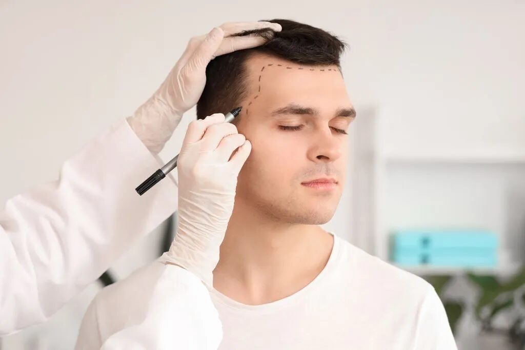 How Does Hair Transplant Restore Youthful Looks?