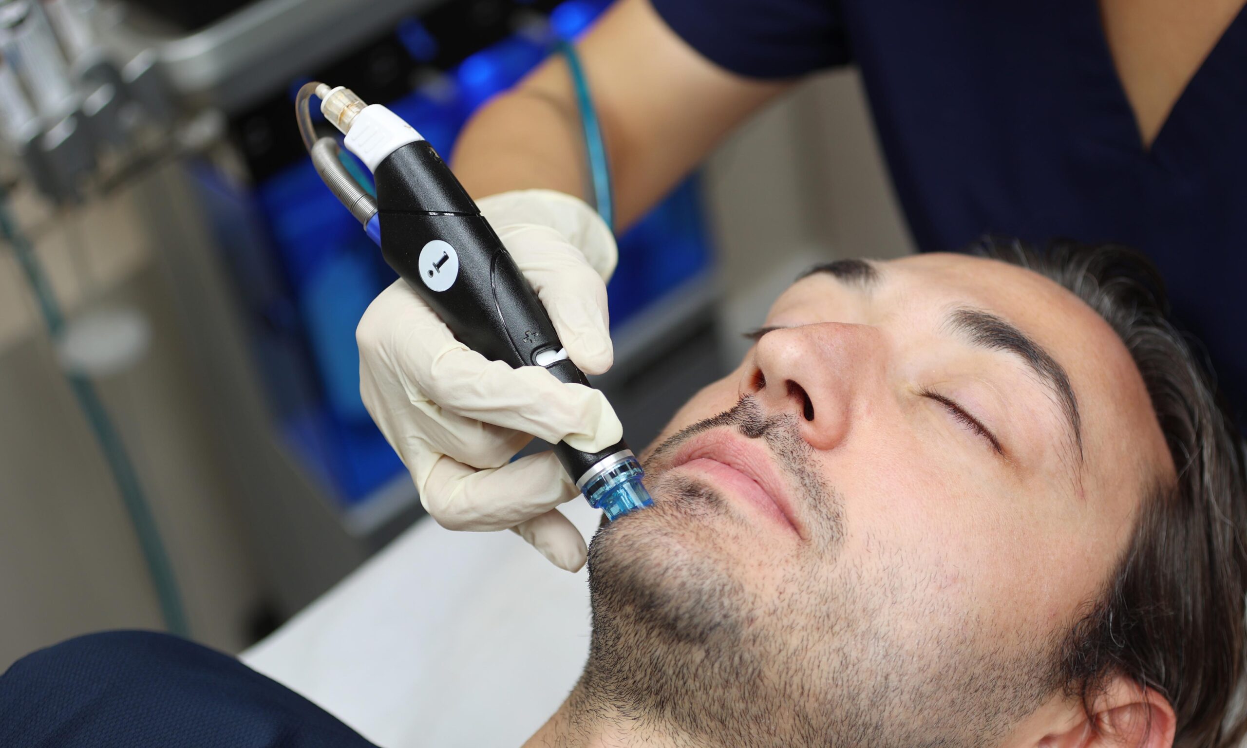 Do Mens Need a Regular Hydrafacial Sessions ?