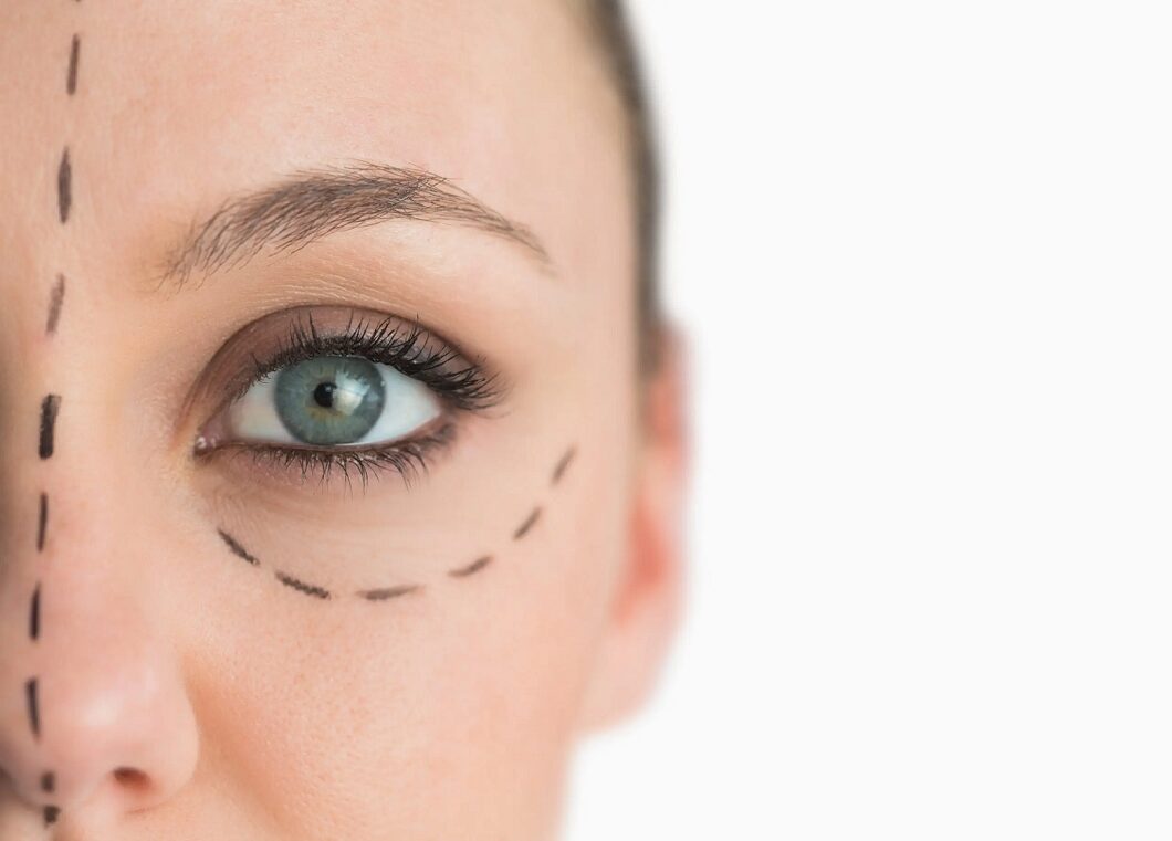 How Eyelid Surgery in Abu Dhabi Helps Tired Looking Eyes