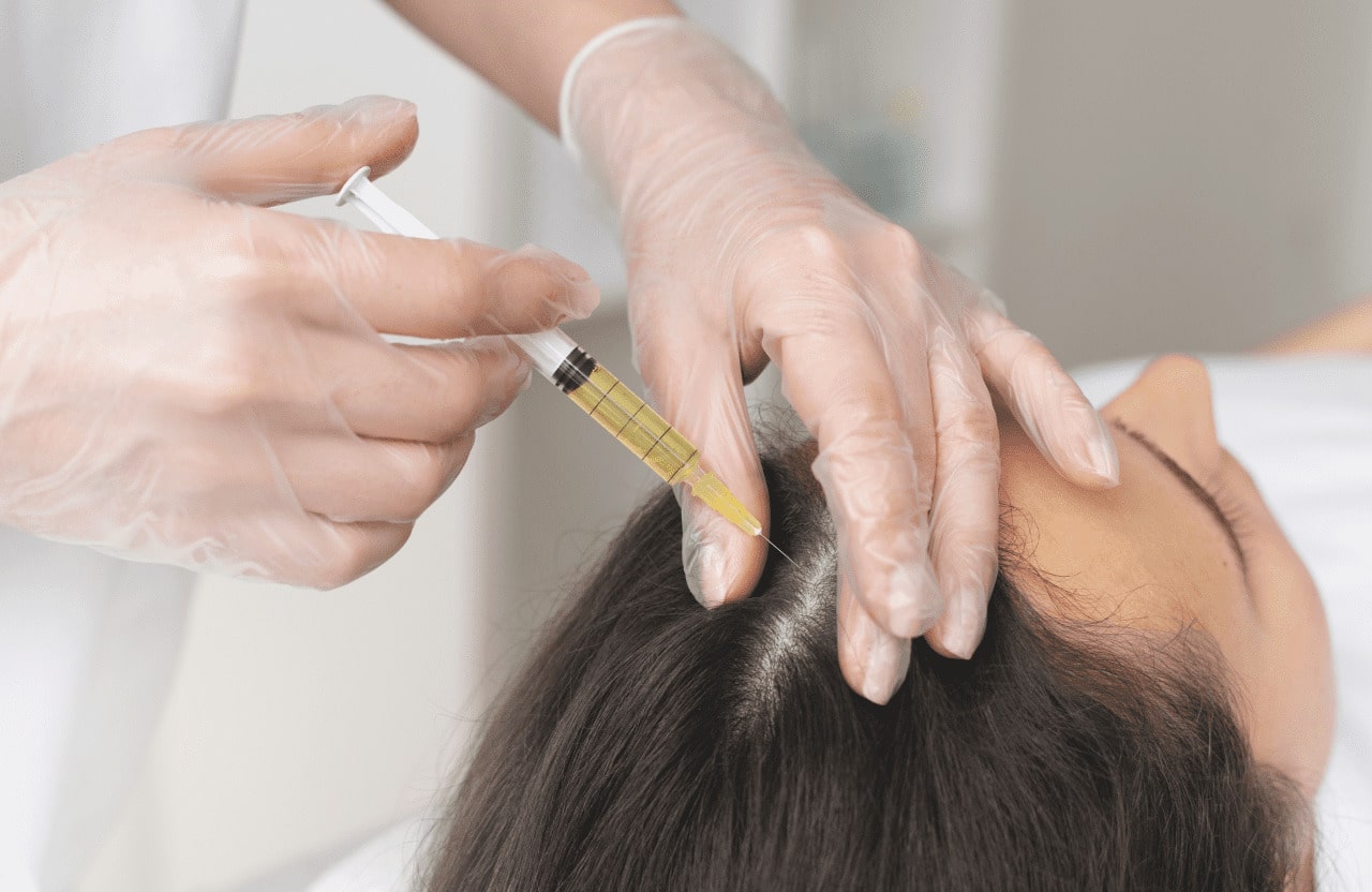 How Hair Fillers Treatment Boosts Hair Growth
