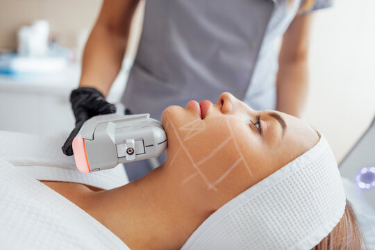 How Often Should You Get HIFU Treatment for Best Results?